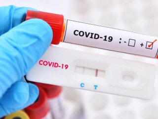 Positive test result of COVID-19 virus