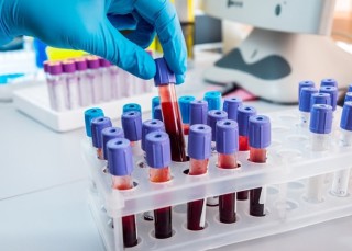 statistika-koronavirus-24-listopada-2020-roku